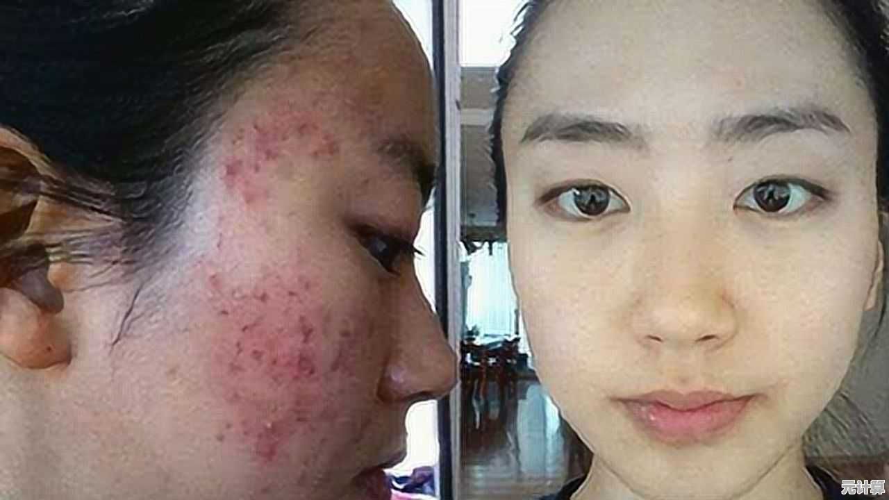 科学祛除痘印的有效方法,让你彻底告别问题肌肤困扰 科学祛除痘印的有效方法,让你彻底告别问题肌肤困扰